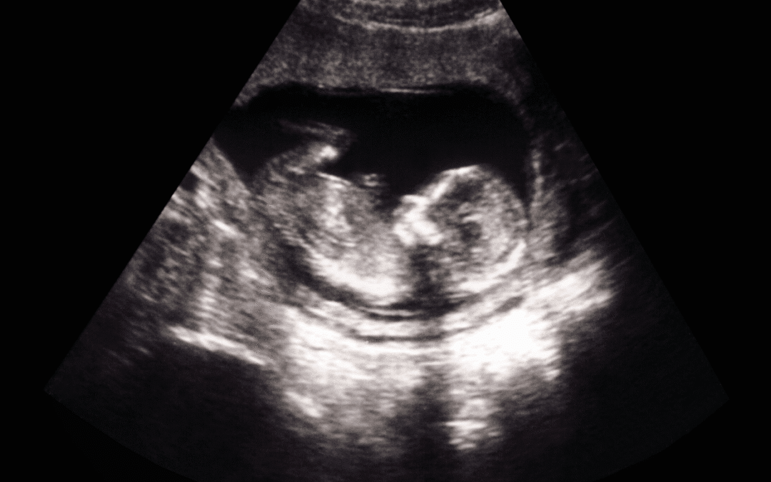 Baby-Ultrasound